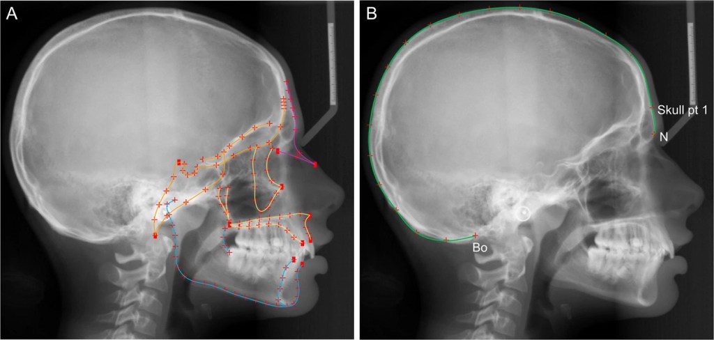 Los humanos están evolucionando para perder dientes 2 Los humanos están evolucionando para perder dientes