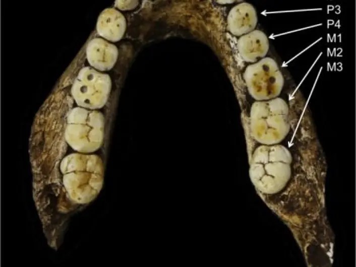 Los humanos están evolucionando para perder dientes 1 Los humanos están evolucionando para perder dientes