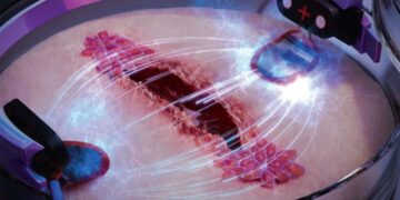 Médicos consiguen usar electricidad para curar heridas