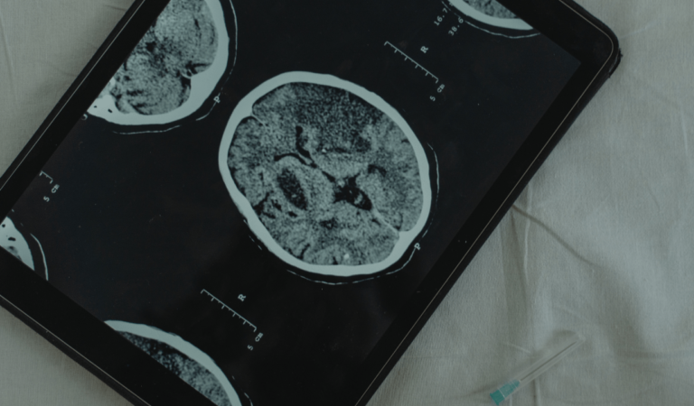 Un implante cerebral que transmite pensamientos en tiempo real