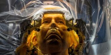 ¿Qué es la enfermedad de Parkinson y por qué es tan difícil de diagnosticar?