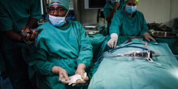 Científicos hacen el primer trasplante de oído medio del mundo utilizando huesos impresos en 3D