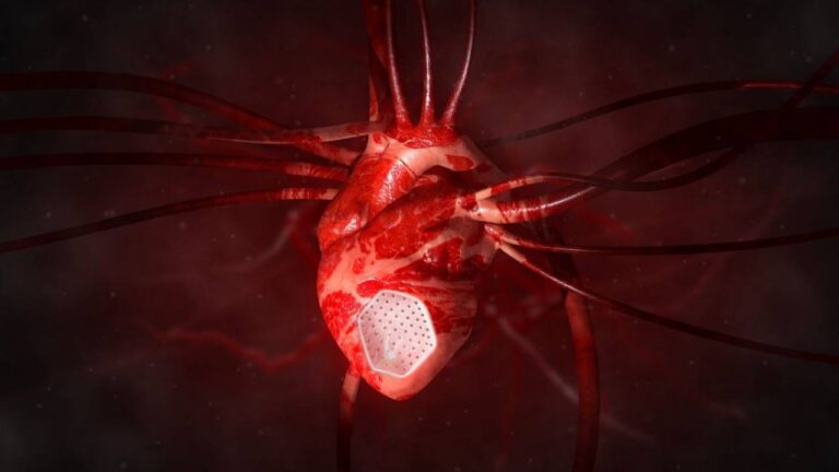 Científicos desarrollan un parche que puede reparar corazones dañados