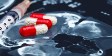 Comisión Europa aprueba el primer tratamiento para detectar temprano el Alzheimer