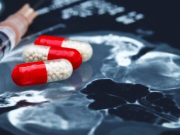 Comisión Europa aprueba el primer tratamiento para detectar temprano el Alzheimer