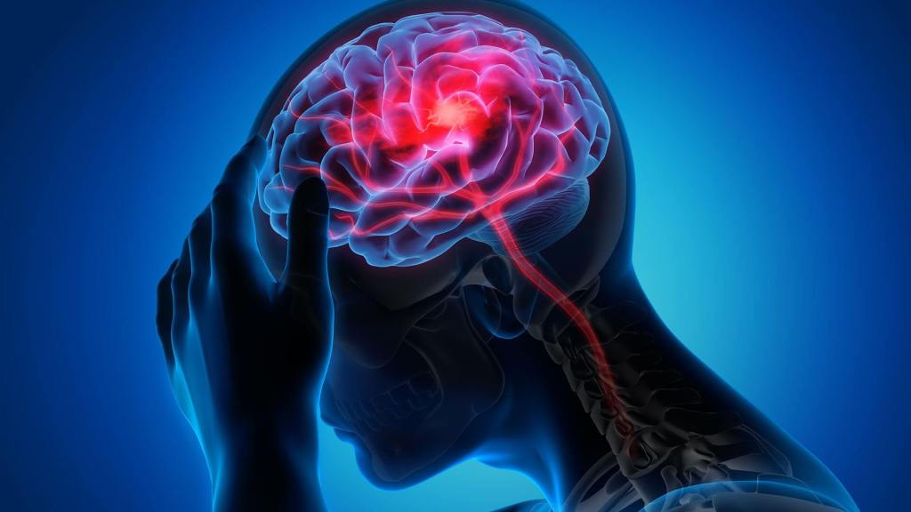 Descubren el primer fármaco para la rehabilitación de accidentes cerebrovasculares 3 Descubren el primer fármaco para la rehabilitación de accidentes cerebrovasculares