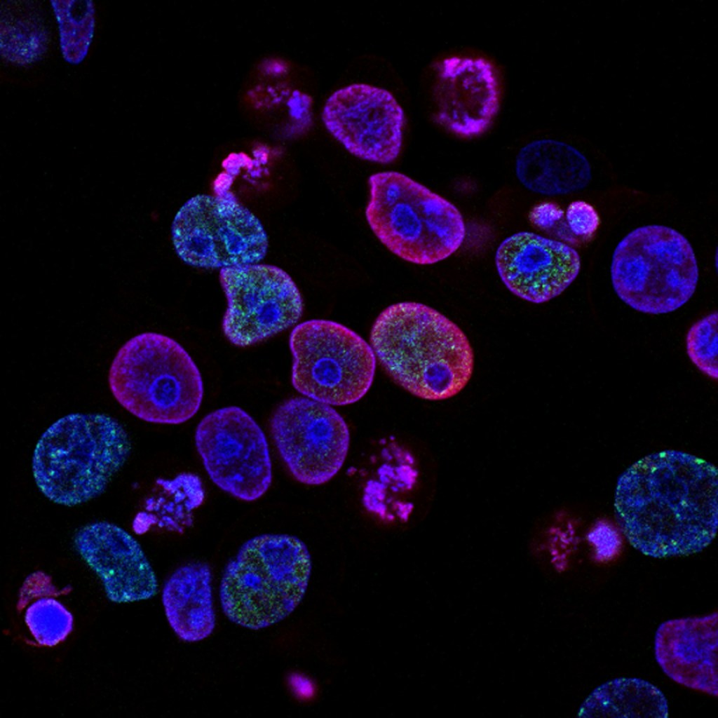 Descubren una tercera vía de herencia genética más allá del ADN y ARN: los amiloides 1 Descubren una tercera vía de herencia genética más allá del ADN y ARN: los amiloides