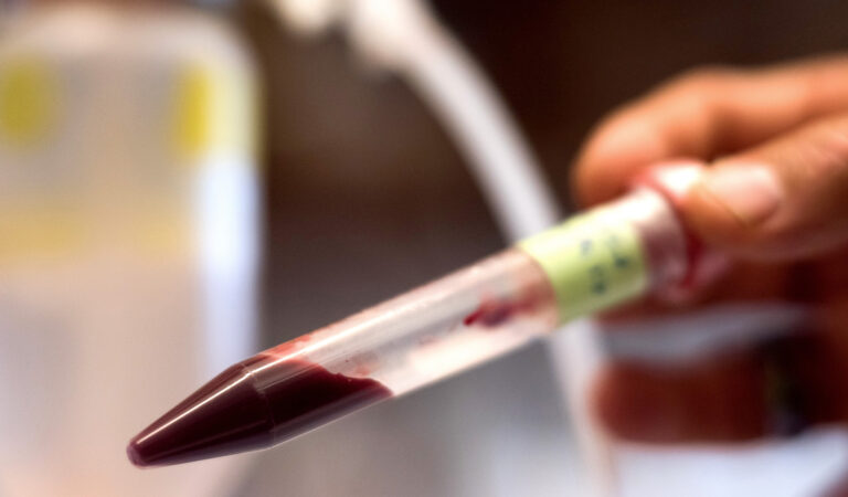 Desarrollan sangre artificial universal que se puede administrar a cualquier los paciente