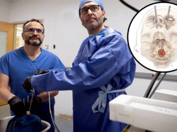 Cirujanos extirpan tumor espinal a través del ojo en una operación sin precedentes